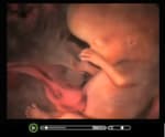 Van bevruchting tot geboorte video