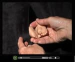 Partial Birth Abortion - Watch this short video clip